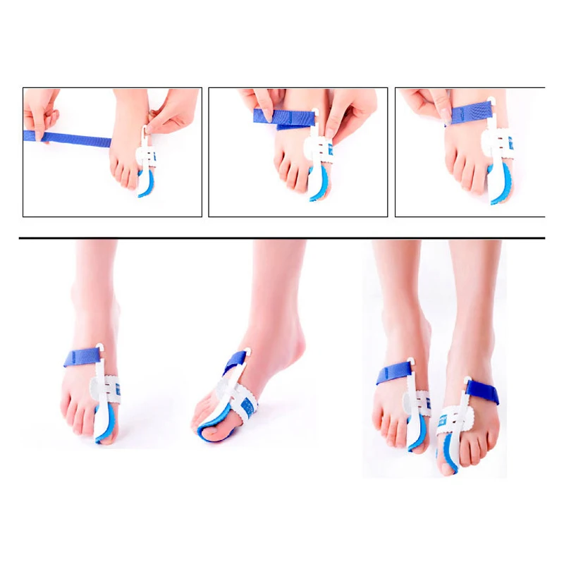1Pair Beetle-crusher Bone Ectropion Toes Separator Hallux Valgus Corrector Night Foot Care Tools Orthotics Braces Bunion Device