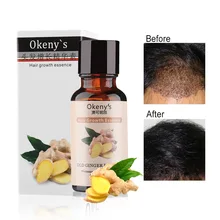 Натуральный экстракт быстрого роста волос Плотные рост имбирь Сыворотки масла эффективной борьбе лечить выпадение Для мужчин t сущность для Для женщин для мужчин