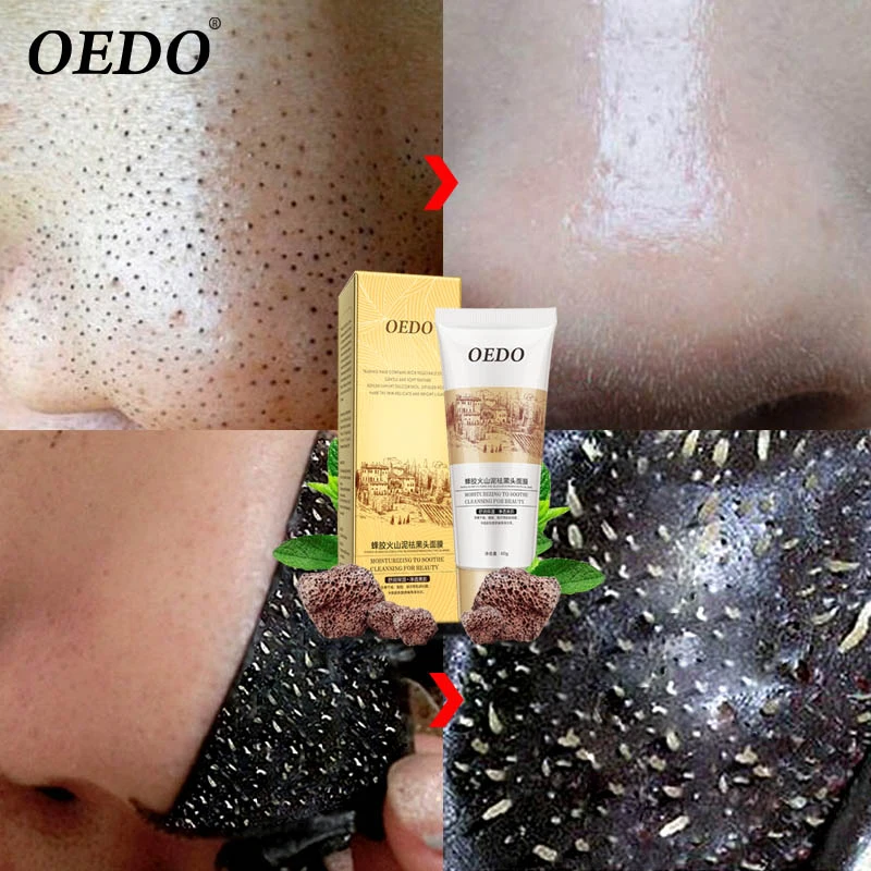 60 г oedo маска от черных точек для удаления маска глубокая Очищающая угорь акне лечебные маски уход за кожей лица маска для лица-in Средства для кожи лица и маски from Красота и здоровье on Aliexpresscom  Alibaba Group