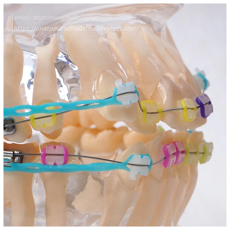 13025 DH202-3 Ortho Ceramic Bracket 