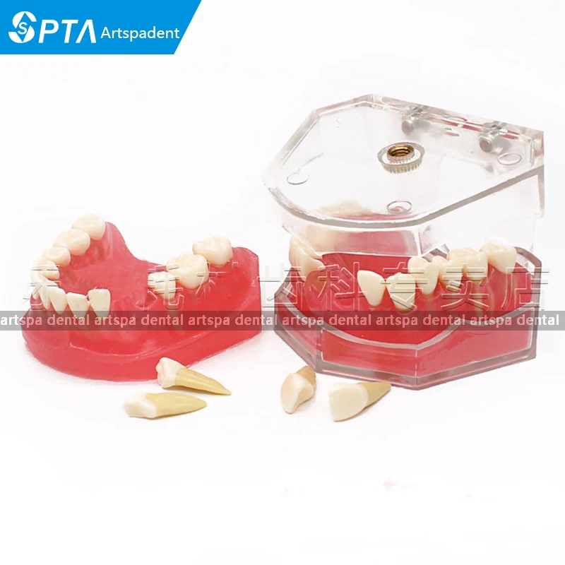 Dental Mold Removable Teeth May Gingival Oral Teaching Model Gingival