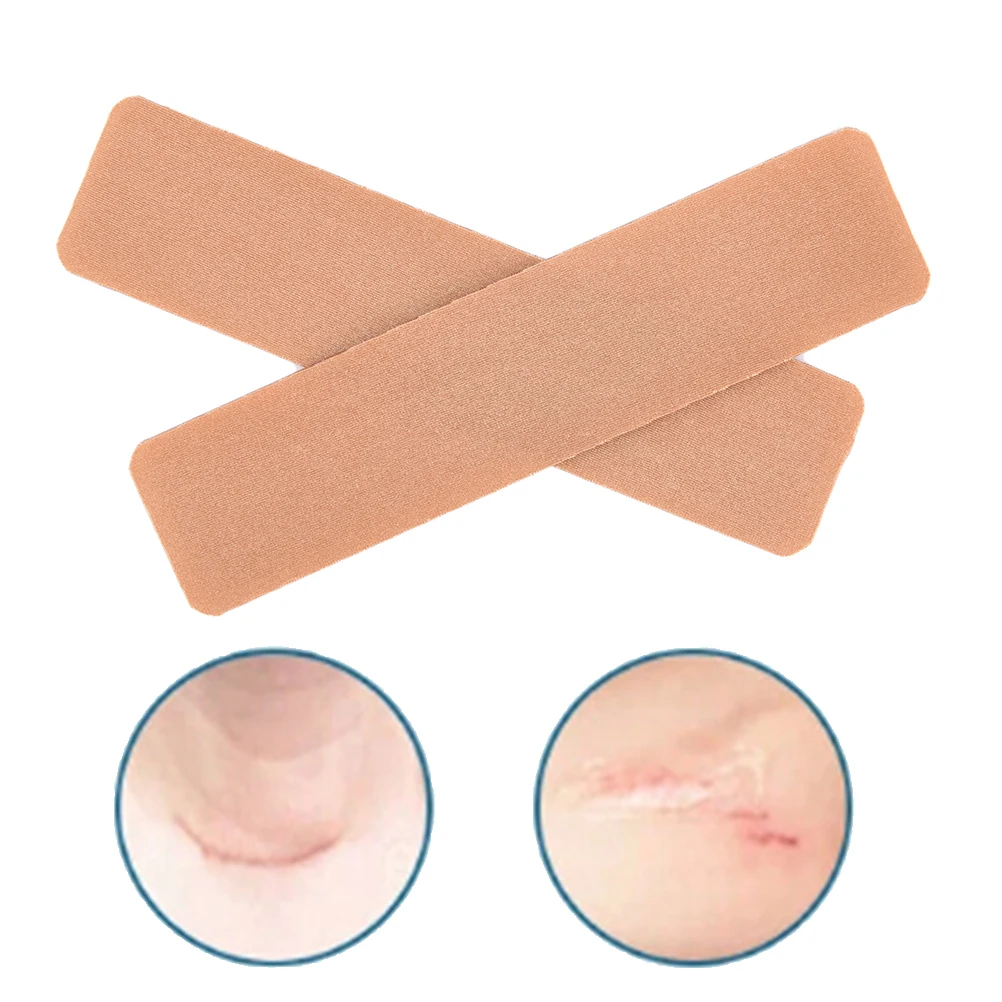 

2pcs/lot Silicone Gel Sheet Wound Marks Cesarean Keloid Skin Scars Removal Scar Away Patch Therapy Treatment 15cm x 3.5cm x 2mm
