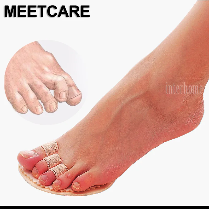 1 Pair Toes Overlap Hammer Toe Correction Pad Soft Bunion Splint