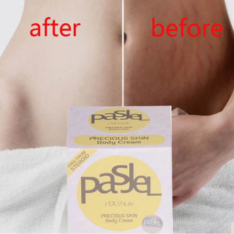 Thailand Pasjel Precious Pregnancy Cream Stretch Marks Remover Scar Removal Powerful Postpartum