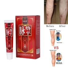 1 шт. лечение Варикозного расширения вен крем для ног крем, мазь васкулита флебит боль ангиит средство для удаления крем для макияжа