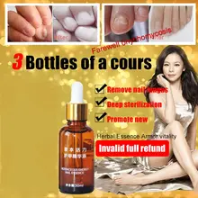 1 шт. Лечение ногтей от грибка эссенция для ногтей и отбеливание ног для кутикулы масло носок удаление грибка Уход за ногами и ногтями гель