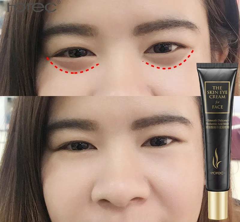 

2018 HOREC Hyaluronic Acid Eye Cream Moisturizing Firming Eye Cream Anti Aging Dark Circles Eye Bags Instant Ageless