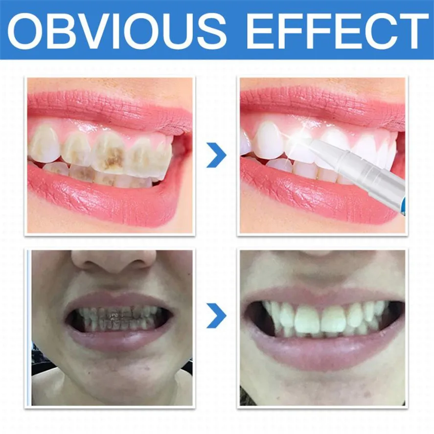 Brand-New-1pc-High-Quality-Teeth-Whitening-Gel-Pen-Quick-Remove-Stain-Yellow-Teeth-Whitening-White (3)