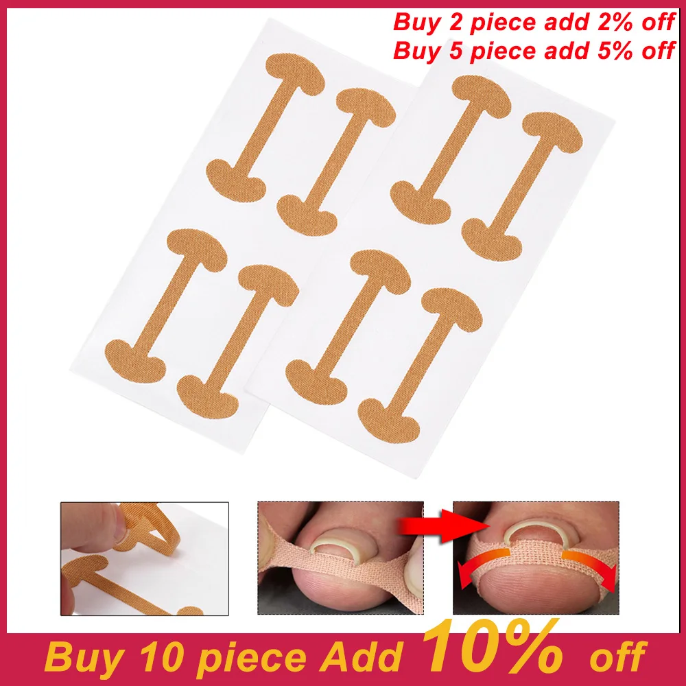 

8Pcs Ingrown Toenail Corrector Stickers Paronychia Treatment Recover Corrector Pedicure Tools Fingernail Toe Nail Care