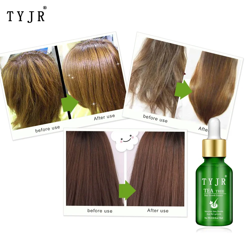 

Tea Tree Nourishing Hair Care Essential Oil Anti-Alopecia Hair Growth Essence Smooth Hair Smoothing Hair Not Dry TSLM1