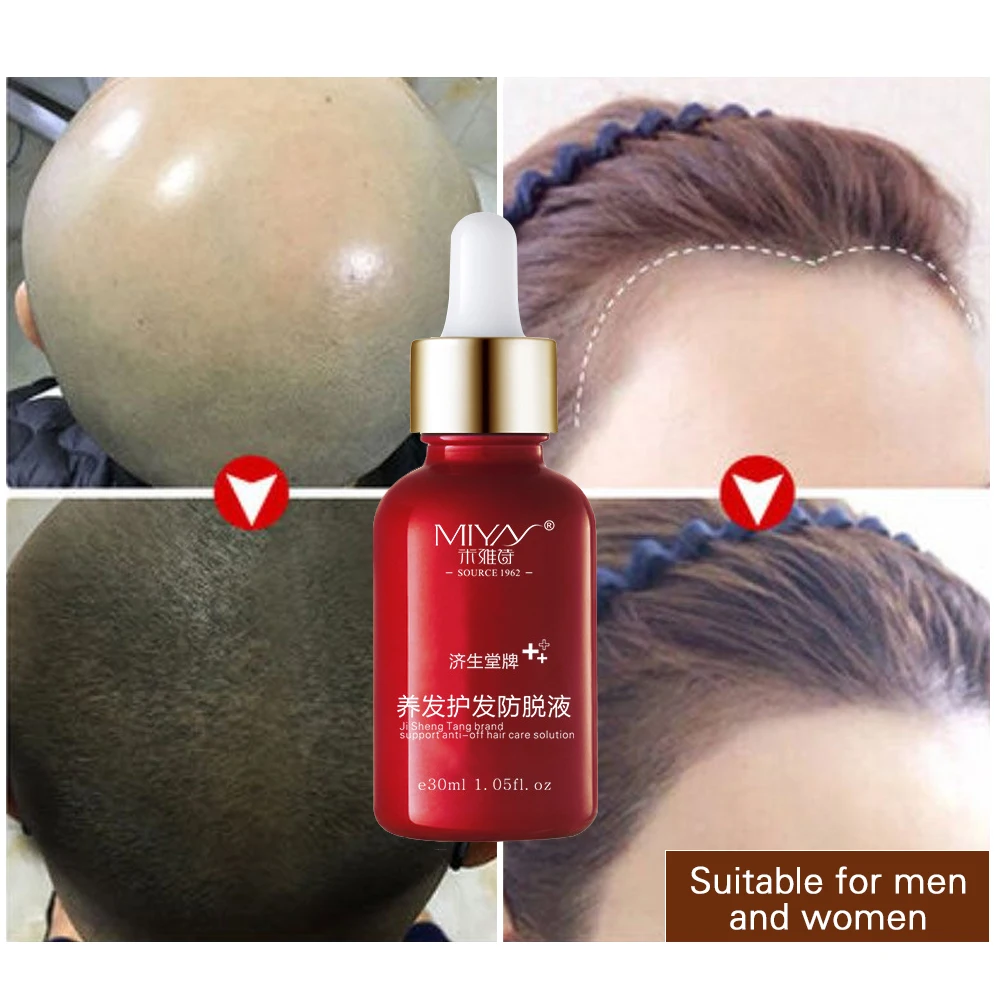 Порошок для роста волос andrea essence против выпадения волос лазер для волос treament hair fall regrowth продукты для мужчин и женщин 30 мл