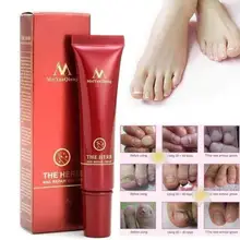 MeiYanQiong травяное Лечение грибка для ногтей onychomicosis Paronychia против грибковой инфекции ногтей китайские травы для ремонта ногтей