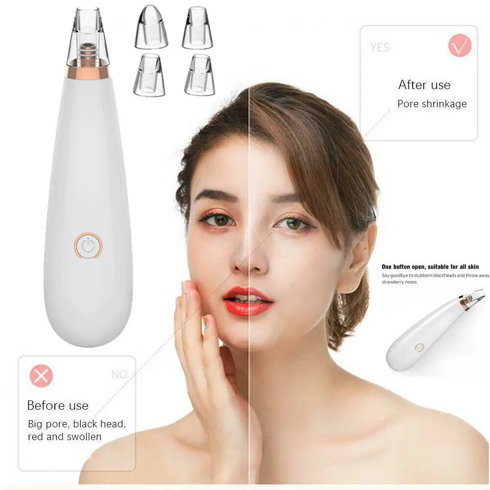 

Electric Facial Skin Care Pore Blackhead Cleaner Remover Vacuum Acne Cleanser