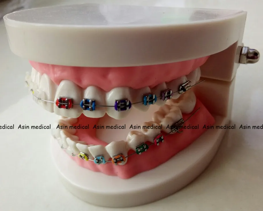 歯科矯正モデル歯科 1 2 標準歯とハーフメタルブラケットハーフセラミックブラケット歯モデル For Dentists Orthodontic Modelteeth Bracket Aliexpress
