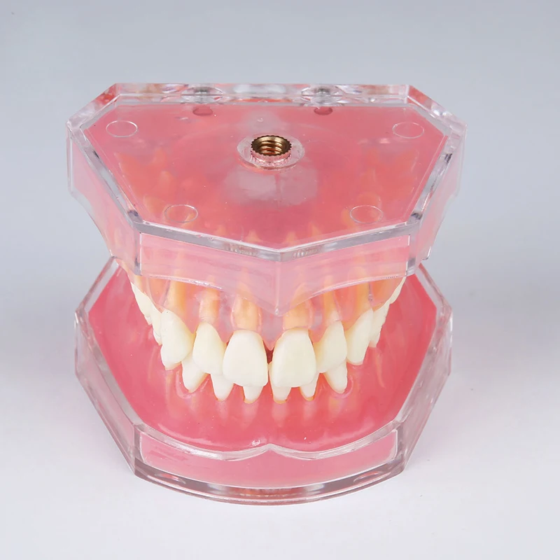 2017 NEW Soft Gingival Dental Mold Removable Teeth May Gingival Oral