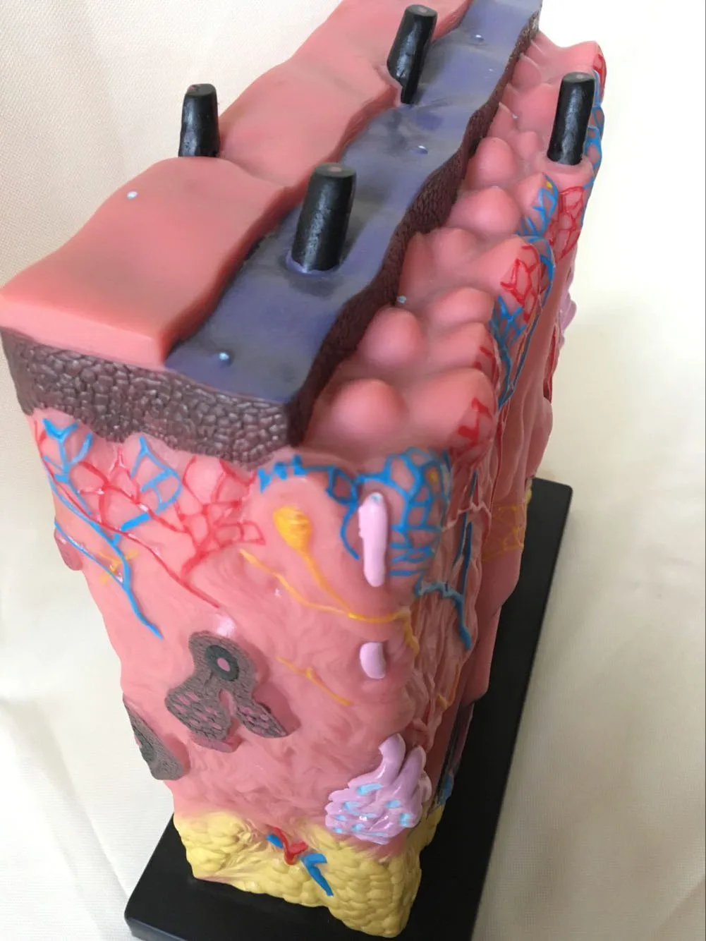 Quality PVC Human Skin Anatomical Model Acne Epidermis Anatomy Pathological Medical Teaching 34X34X16CM | Канцтовары для офиса и