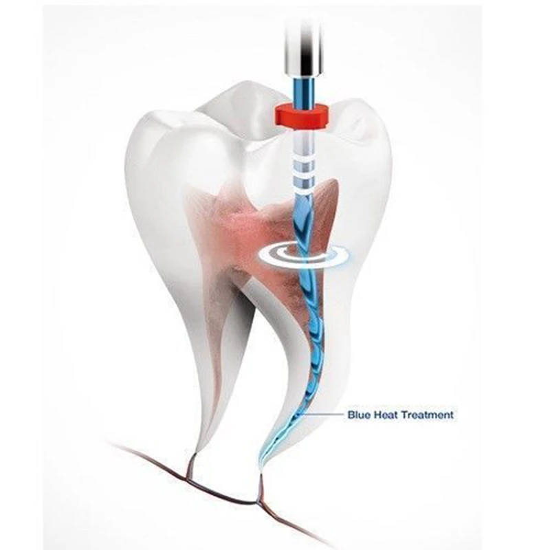 

6pics Dental reciproc blue files Gutta Percha points endodontic niti files use for Root canal cleaning dentistry