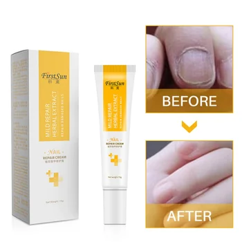 

High Quality Nail Protector Skin Care Cream Nail Fungus Treatment Herb Nails Repair Cream Nail Care Tools