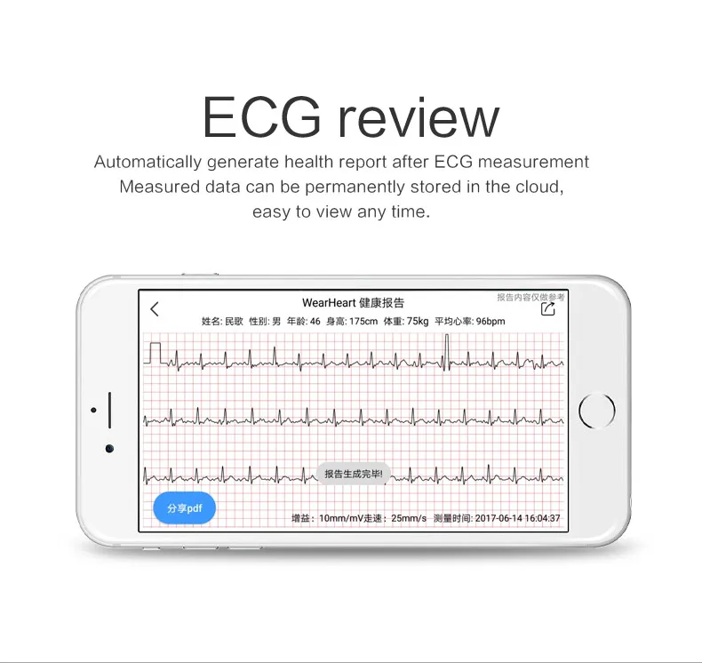 Лучшие продажи ECG PPG двойной HR измерения Smartband браслет с шагомером калорий спортивный браслет для мужчин и женщин