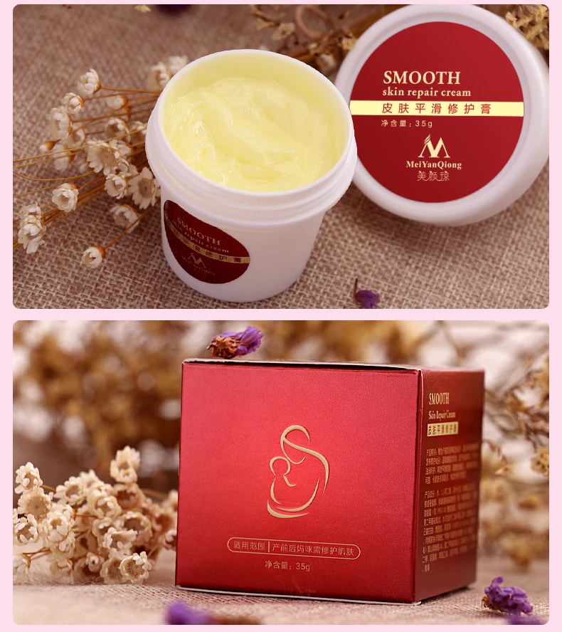 Creme de Pele para Estrias Remoção da Cicatriz para Reparação da Pele Dropshipping Suave Maternidade Creme Corporal Remover Cicatriz Pós-parto 10 Pçs 12 Maternidade