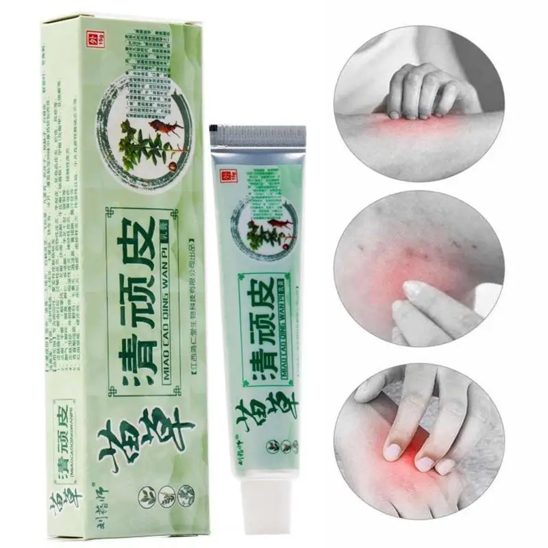 

Hot psoriasis treatment cream Skin care Dermatitis Eczematoid Eczema Ointment eczema cream psoriasis Itching relief Skin Crea