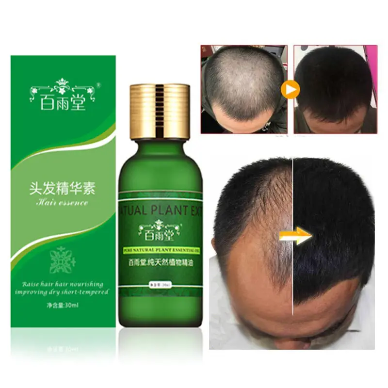 

Hair Care Hair Growth Essential Oils Essence Original Authentic 100% Hair Loss Liquid Health Care Beauty Dense Serum Useful 30ML