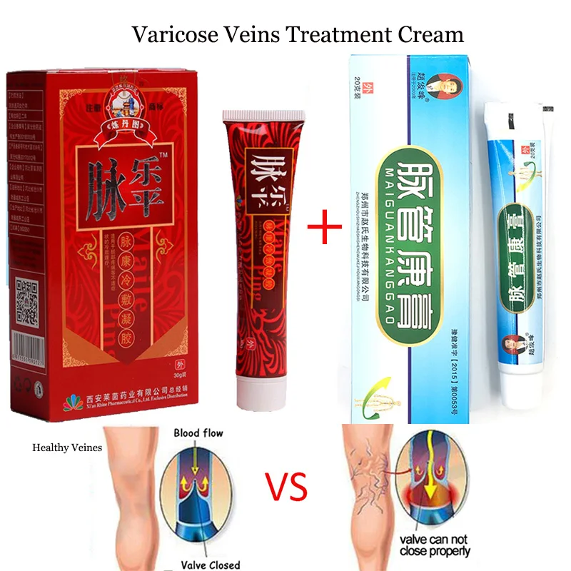 

Varicose Veins Treatment Cream Ointment Vasculitis Phlebitis Spider Veins Pain Varicosity Angiitis Remedy Removal Leg Maddager