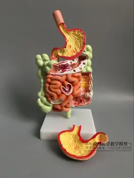 

Human gastrointestinal pathology model digestive tract gastric coronal section transverse colon gastrointestinal anatomy model