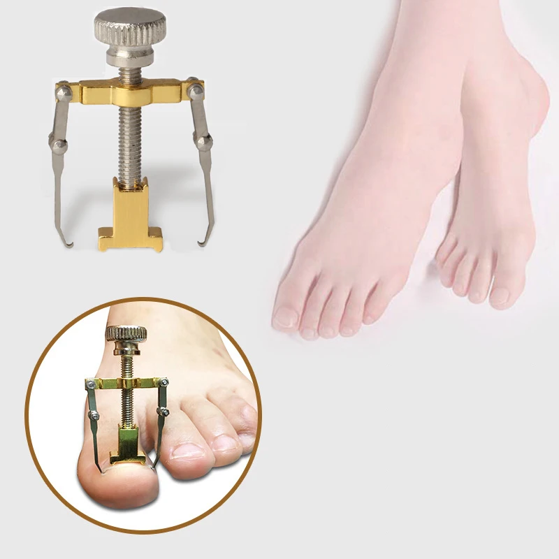 

Ingrown Armor Toe Nail Correction Pedicure Fixer Straightener Clippers Recover Set Clamp Scissors Nail Correction Device Tool