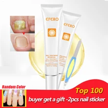EFERO Уход за ногтями, восстанавливающий крем для ногтей, оонихомикоз, пароникья, противогрибковый гель для удаления ногтей, анти-инфекция, грибок для ногтей