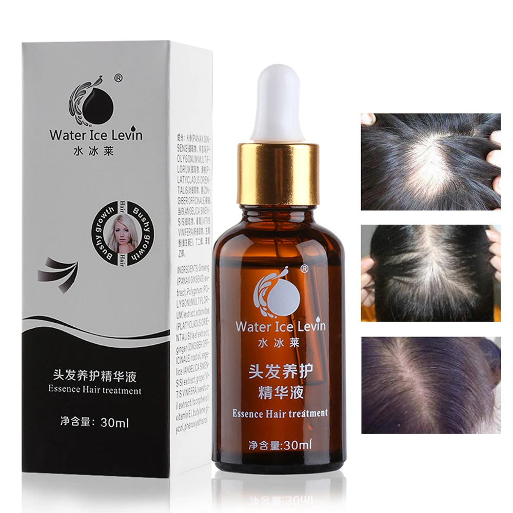 Hair Growth Oil Hair Loss Prevention Treatment For Men Women With