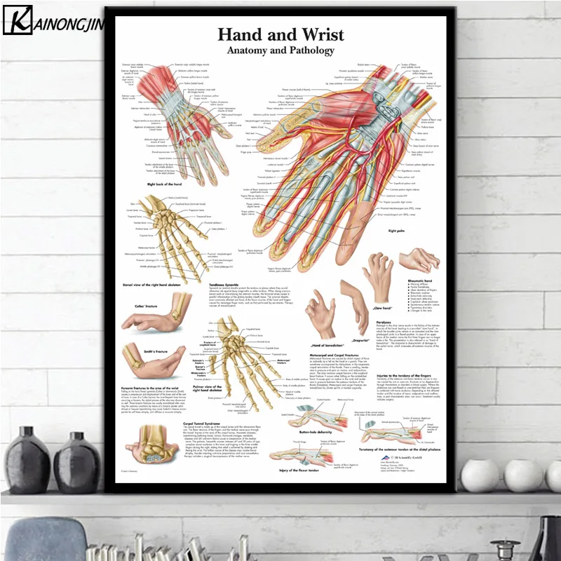 Плакат коленного сустава ноги позвоночника мышцы системы Анатомия плакаты и принты холст картина стены Искусство Картина комнаты домашний декор - Цвет: 0004