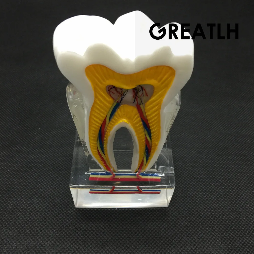 Dental Anatomical Molar Model 2017 molar inner structure with nerves and vessels