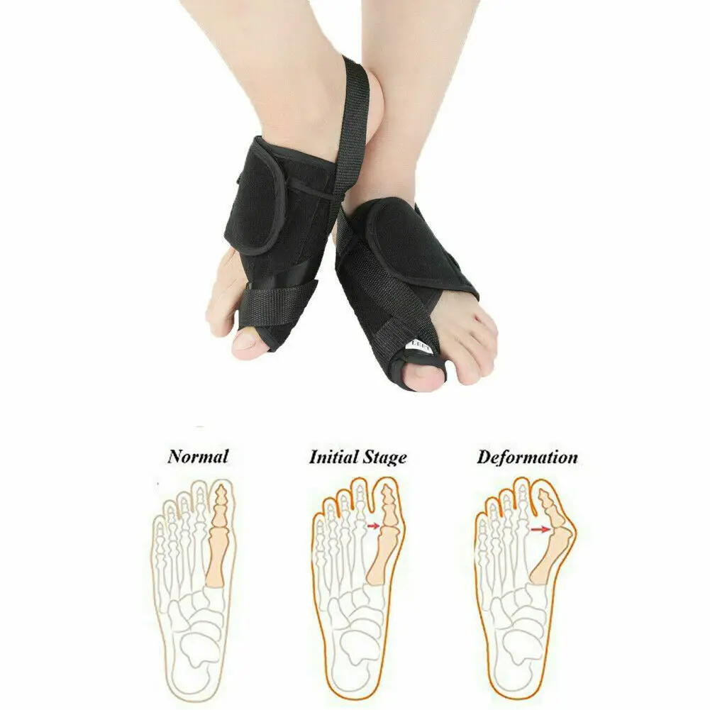 

2019 Hot Sale Foot Care Bunion Splint Big Toe Straightener Corrector Foot Pain Relief Hallux Valgus Orthopedic Supplies Pedicure
