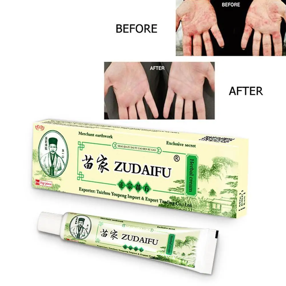 Обновление 1 шт. 15 г Zudaifu псориаз уход за кожей мазь уход за здоровьем крем Защита от дерматита экзематоидная мембрана штукатурка