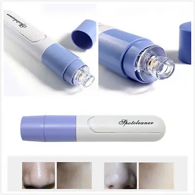 Electric Facial Pore font b Cleanser b font Skin Cleaner Dirt Suck Up Vacuum Acne Pimple