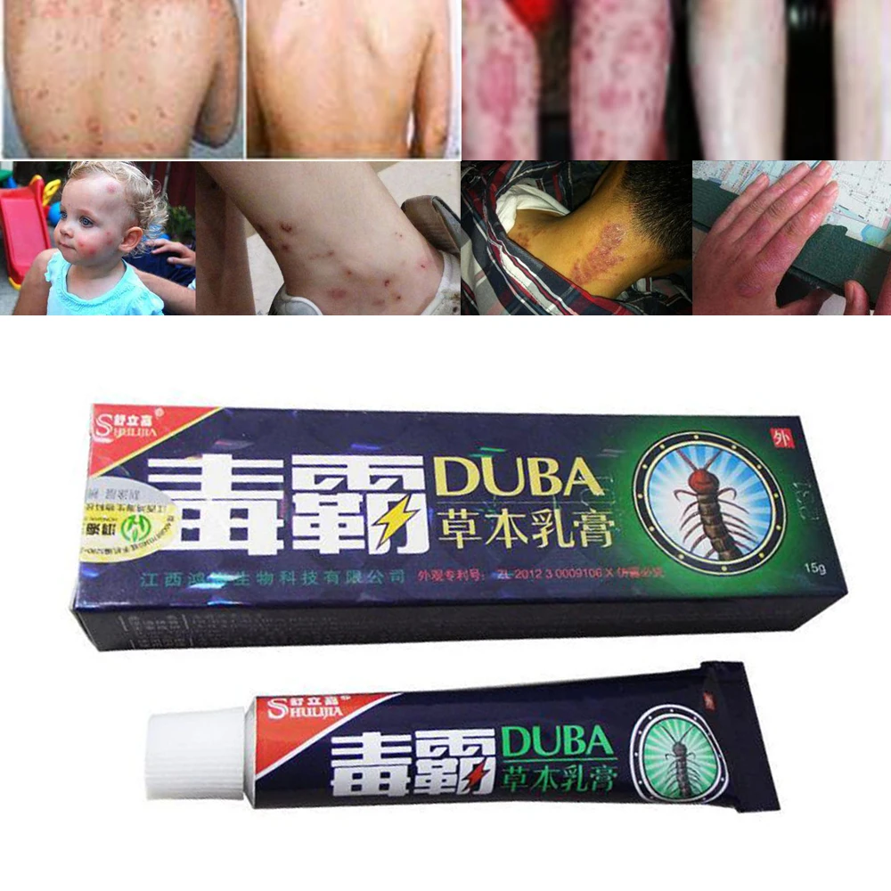 1 шт. Китайский крем для тела от псориаза, товары для здоровья, крем для лечения псориаза, травяная мазь, кремы для массажа кожи D084
