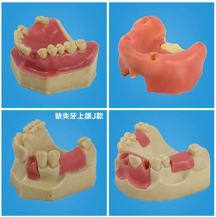 Стоматологические материалы модель орального имплантата хирургические maxillary sinus Стоматологические принадлежности оборудование инструменты мягкие десны