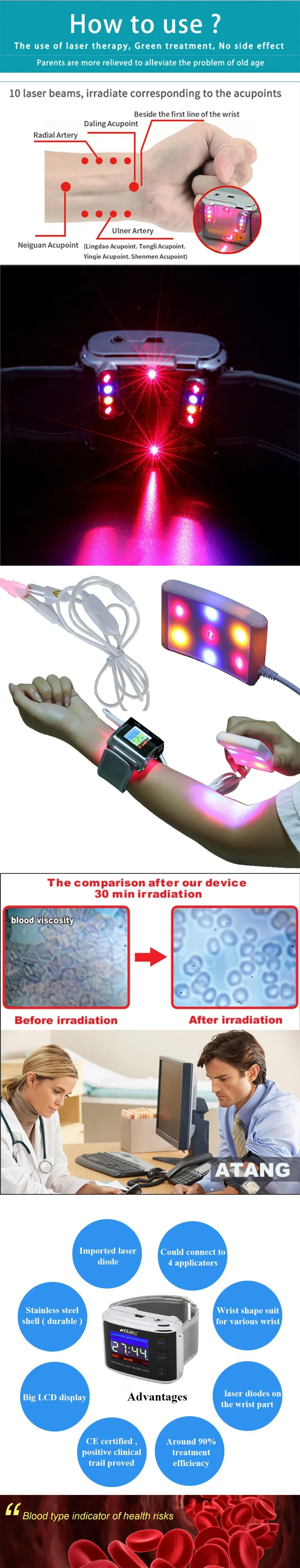 Rehabilitation physiotherapy Household portable instrument Care for health watch blood sugar treatment treatment insomnia