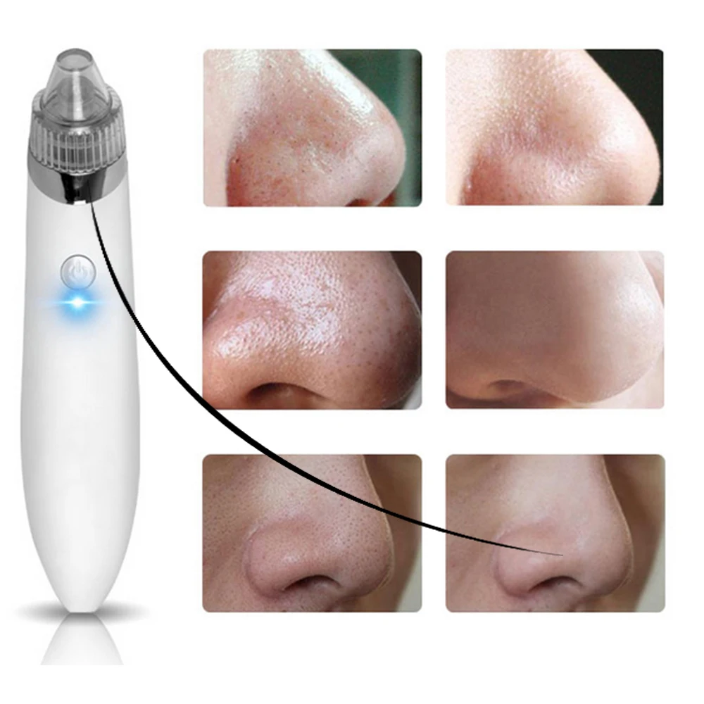 

Facial Blackhead Remover Vacuum Dead Skin Acne Pore Peeling Device Cleaning Skin Tool Suck Out Blackhead Beauty Machine Plug-in