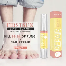 Zhenduo Firstsun nail clipper removes nail fungus bright nail bio-protective film nail repair fluid Zhenduo Firstsun nail clipper removes nail fungus bright nail bio-protective film nail repair fluid
