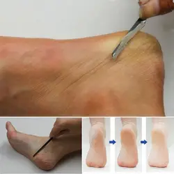 2 шт. педикюр/маникюр очиститель для ногтей роговой изменение мертвой кожи строгания ног Уход