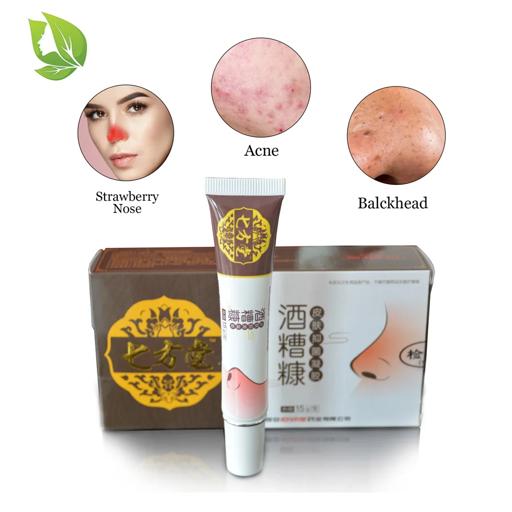

2 packs Anti Nose Mites Remove Acne Rosacea Cream Red Nose Blackhead Remover Acne Treatment Shrink Pores Face Bleaching Ointment