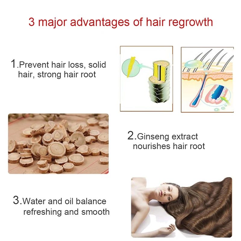 Роста волос против выпадения волос жидкость 20 мл густые волосы быстро рост Выжженных волос расти недействительным возврат облысения SQ11