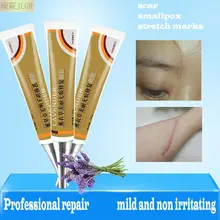 Беременность, удаление растяжек, крем, оспа, крем para estrias, био масло, тело, крем для удаления шрамов, гравидез, stretchmark