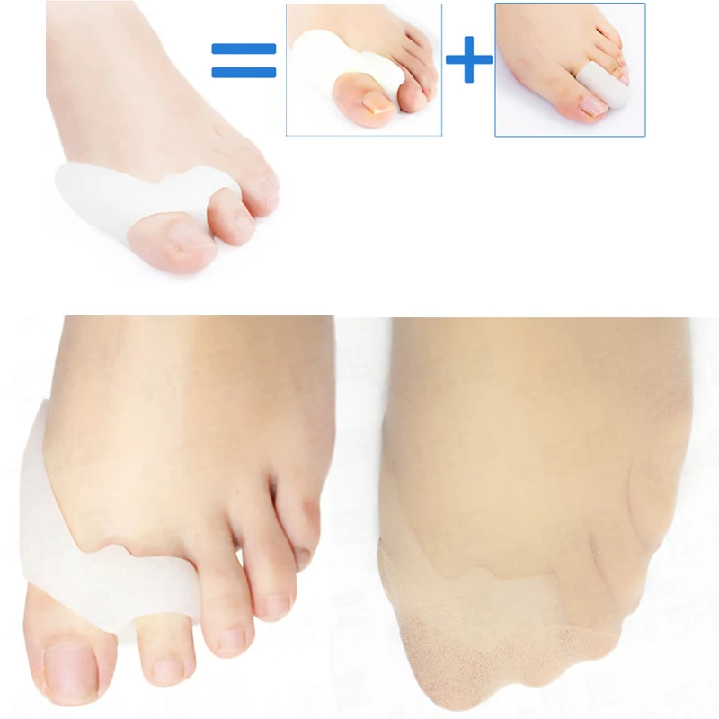 Бестселлер- кремнийорганический гель-сепаратор пальцов ноги и предохранитель пальцов-выворот и установщик кисты пальцов ноги