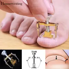 Фиксатор Уход за ногтями на ногах педикюр восстановление коррекции Ортез на ногти прибор