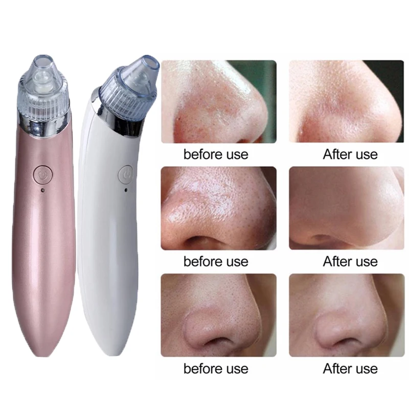 

Diamond Dermabrasion Blackhead Vacuum Cleaner Suction Removal Scar Acne Pore Peeling Face Clean Facial Skin Care Beauty Machine