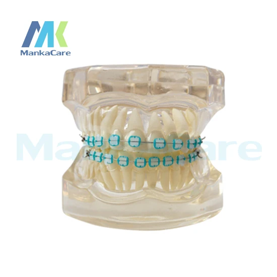 Manka Care 28 pcs Tooth, all ceramic bracket Oral Model Teeth Tooth