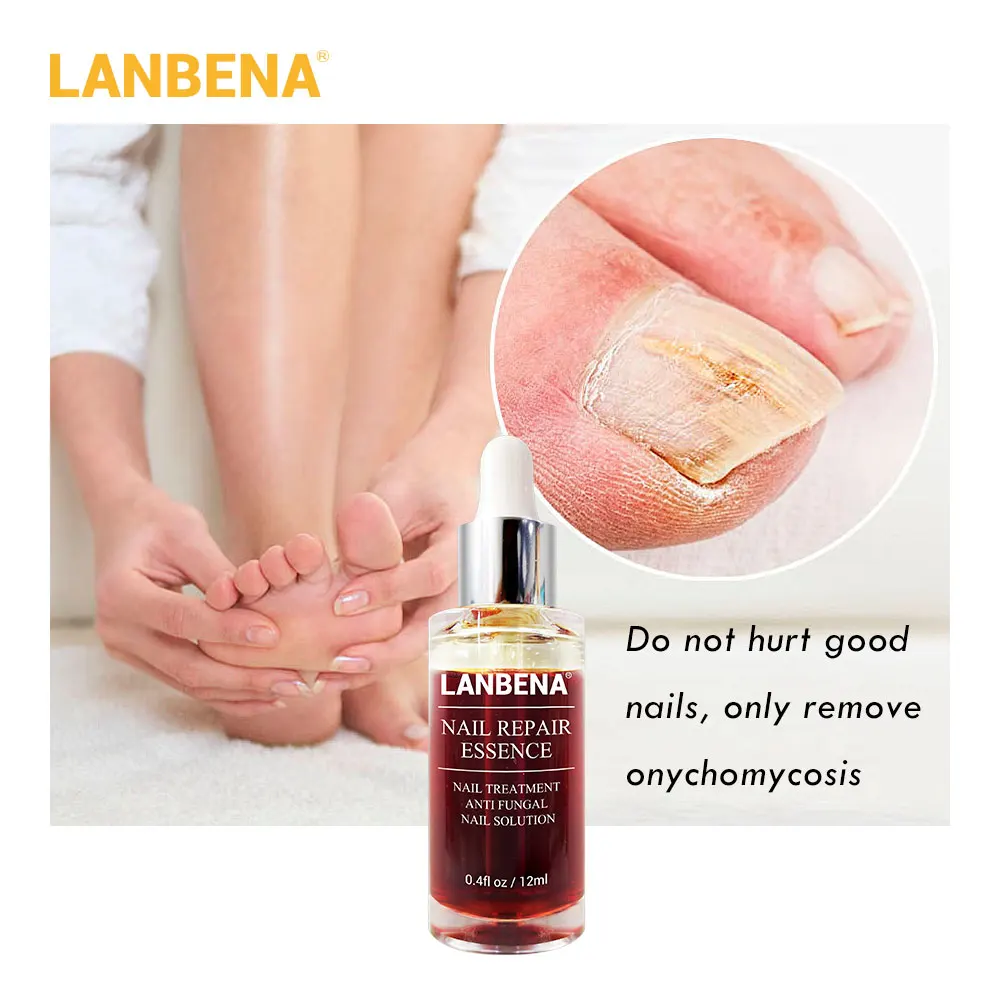 

LANBENA Nail Repair Essence Serum Fungal Nail Treatment Remove Onychomycosis Toe Nourishing Brighten Hand Foot Skin Care 12ml